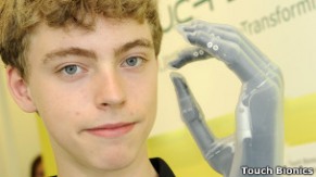 Após carta, menino ganha mão biônica de equipe de Fórmula 1