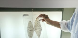 Curativo com pele de tilápia desenvolvido pela UFC será enviado ao espaço pela Nasa