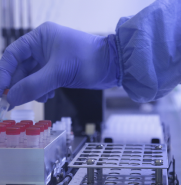 Falta de investimento e estratégia para inovação dificultarão saída da crise no Brasil